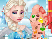 Elsa Foot Doctor Game