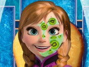 Anna Frozen Makeover
